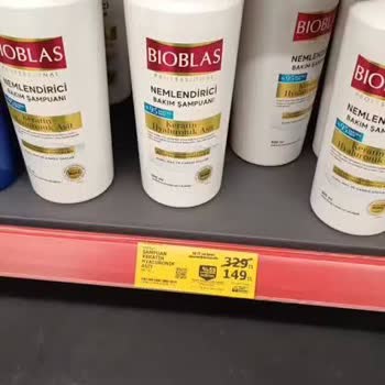 Bioblas Şampuan Nedeniyle Yaşadığım Ciddi Saç Derisi Tahrişi Ve Mağduriyet
