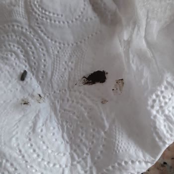 Aldığım Pirinçte Fare Dışkısına Benzeyen Parçalar Çıktı: Hijyen Ve Güven Sarsıldı