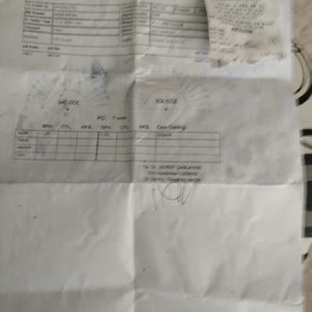 Yanlış Ölçüm Nedeniyle Başarısız Katarakt Ameliyatı Ve Maddi Mağduriyet