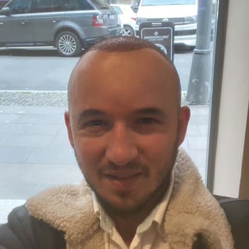 İsveç Klinik İki Kez Saç Ekimi Sonrası Hayal Kırıklığı ve Mağduriyet Yaşadım