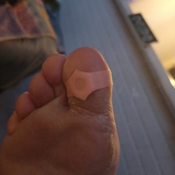 Tuba Nasır Yakısı'nda Dar Bant Sorunu: Kullanım Zorluğu Ve Etkisiz Sonuç