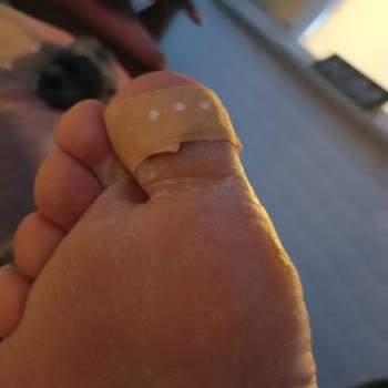 Tuba Nasır Yakısı'nda Dar Bant Sorunu: Kullanım Zorluğu Ve Etkisiz Sonuç