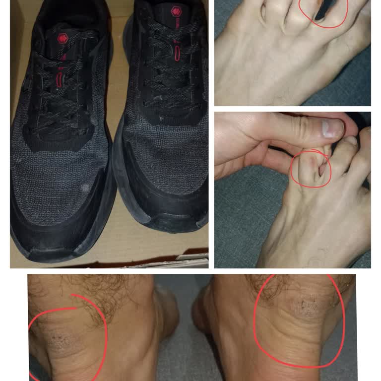 Fiziksel Rahatsızlık Veren Ayakkabıya Rağmen Mağazada Çözüm Bulamadım