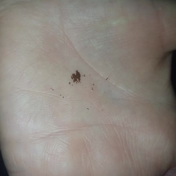 Kahve Kutusundan Metal Parça Çıkması Nedeniyle Güven Kaybı Ve Değişim Talebi