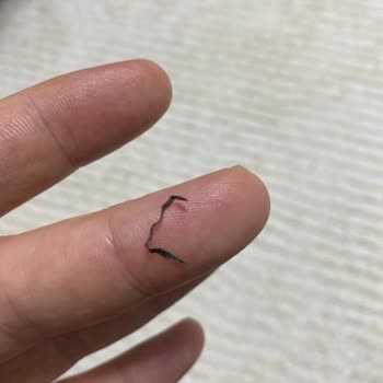 Aldığım Cips Fıstıktan Demir Parçası Çıktı: Sağlığım Tehlikeye Girdi