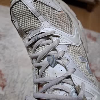 Aldığım Ayakkabı 9 Ayda Yırtıldı, SuperStep Sorumluluk Almadı