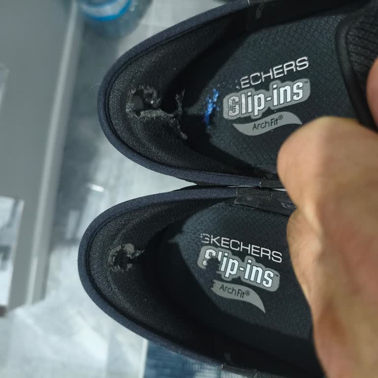 Kısa Sürede Deforme Olan Skechers Ayakkabıda Hayal Kırıklığı