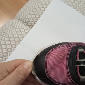Kısa Sürede Açılan Skechers Ayakkabıya Kullanıcı Hatası Denmesi Mağduriyetimi Artırdı