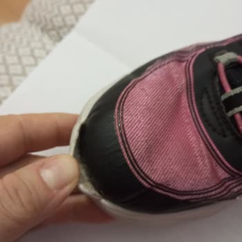 Kısa Sürede Açılan Skechers Ayakkabıya Kullanıcı Hatası Denmesi Mağduriyetimi Artırdı