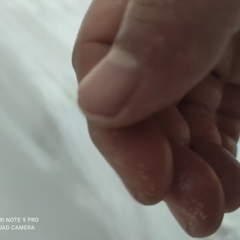 Domol Leke Çıkarıcı Ciltte Yanık Oluşturdu, Ambalajda Uyarı Yok!