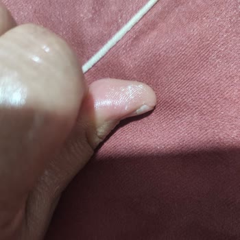 Domol Leke Çıkarıcı Ciltte Yanık Oluşturdu, Ambalajda Uyarı Yok!