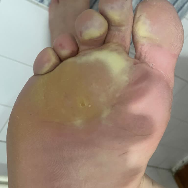 Bodylita Ayak Kokusunu Azaltması Gereken Ürün Tam Tersi Etki Yaptı!