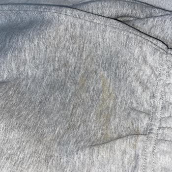 Pull And Bear Online Alışverişte Karşılaşılan Kalite Sorunları Ve Mağduriyet Talebi