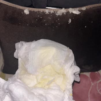 Molfix Bebek Bezinden Çıkan Kristaller Oğlumda Pişiğe Ve Sızıntıya Neden Oldu