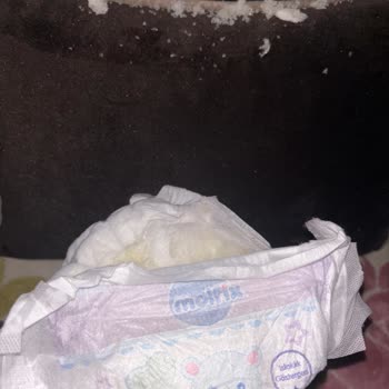 Molfix Bebek Bezinden Çıkan Kristaller Oğlumda Pişiğe Ve Sızıntıya Neden Oldu