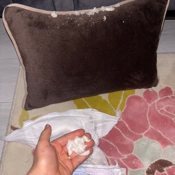 Molfix Bebek Bezinden Çıkan Kristaller Oğlumda Pişiğe Ve Sızıntıya Neden Oldu