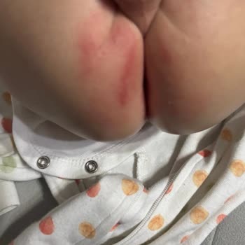 Molfix Bebek Bezinden Çıkan Kristaller Oğlumda Pişiğe Ve Sızıntıya Neden Oldu