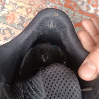 Kısa Sürede Deforme Olan Adidas Ayakkabı İçin Garanti Mağduriyeti Yaşadım