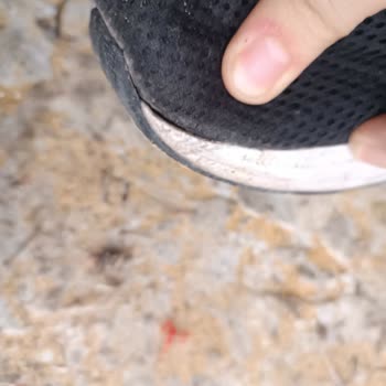 Kısa Sürede Deforme Olan Adidas Ayakkabı İçin Garanti Mağduriyeti Yaşadım