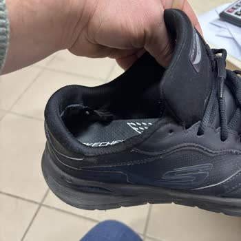 Kısa Sürede Deforme Olan Skechers Ayakkabı Ve Yetersiz Müşteri Hizmeti
