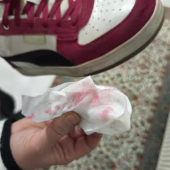 Aldığım Ayakkabının Boyası Akıyor, Değişim Talebim Reddedildi