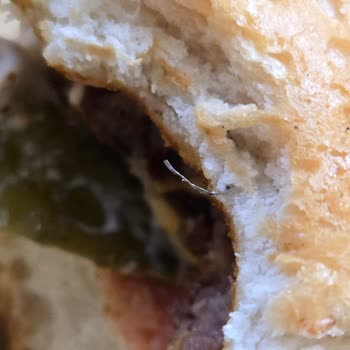 Hamburgerimde Tel Çıktı, Sağlığım Tehlikeye Girdi!