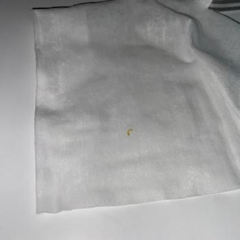 Yenidoğan Islak Mendilde Çıkan Yabancı Madde Endişesi