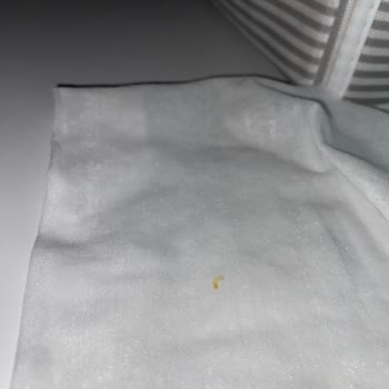 Yenidoğan Islak Mendilde Çıkan Yabancı Madde Endişesi