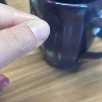 Yanlış Ürün Ve Hijyen Sorunu Sonrası Çözüm Bulamamak Mağduriyetimi Artırdı