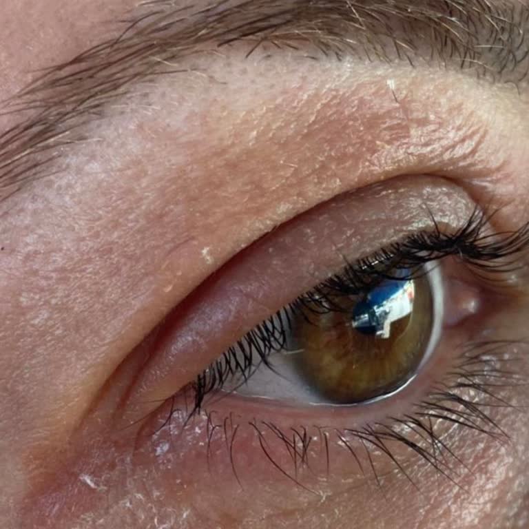 L’OREAL Yaş Uzmanı 40+ Krem Cildimde Yanık Ve Kızarıklık Yaptı