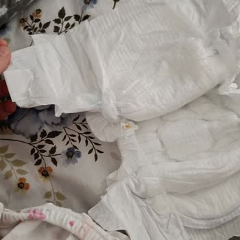 Molfix Bebek Bezinde Tekrar Eden Cırt Eksikliği Güvenimi Sarstı