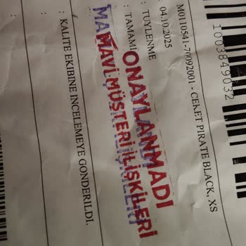 Mavi Ceketten Çıkan Tüyler Ve Özensiz İnceleme Süreci Hayal Kırıklığı Yaşattı