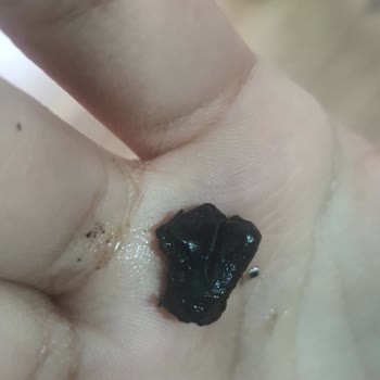 Mantı Ürününde Yabancı Madde Ve Sağlıksız Tat Endişesi