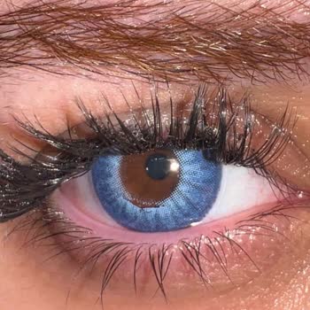 Sorunlu Lens Ve Haksız Kargo Ücreti Sonrası Müşteri Memnuniyetsizliği Yaşadım