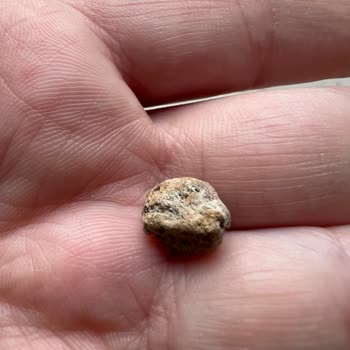 Duru Barbunyadan Çıkan Taş Küçük Çocuğum İçin Büyük Tehlike Oluşturdu