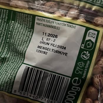 Duru Barbunyadan Çıkan Taş Küçük Çocuğum İçin Büyük Tehlike Oluşturdu