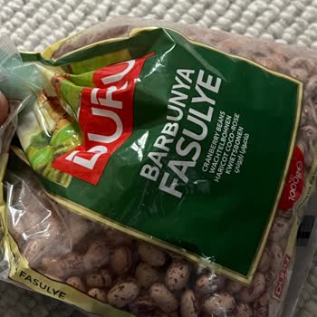 Duru Barbunyadan Çıkan Taş Küçük Çocuğum İçin Büyük Tehlike Oluşturdu