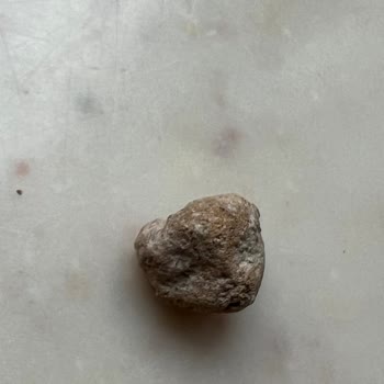 Duru Barbunyadan Çıkan Taş Küçük Çocuğum İçin Büyük Tehlike Oluşturdu