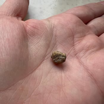 Duru Barbunyadan Çıkan Taş Küçük Çocuğum İçin Büyük Tehlike Oluşturdu