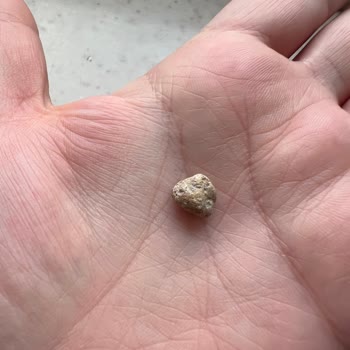 Duru Barbunyadan Çıkan Taş Küçük Çocuğum İçin Büyük Tehlike Oluşturdu