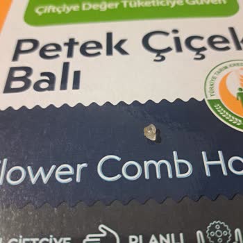 Sahte Çiçek Balı Nedeniyle Çocuklarımın Boğazına Takılan Şeker Parçaları