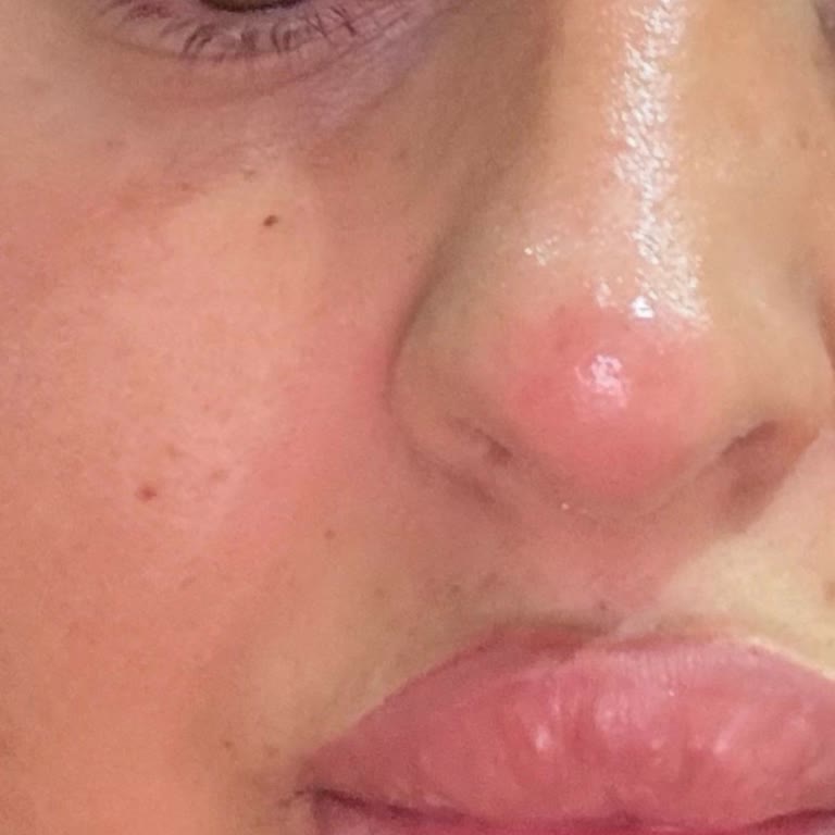 Mayesthe Clinic Mağduriyeti