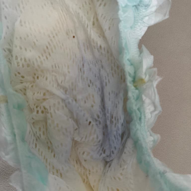 Prima Premium Bezinde Mavi Boya Üretim Hatası ve Sağlık Güven Endişesi