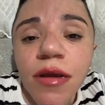 Instagram'ım Kapatıldı Açılsın Lütfen!