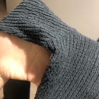 Kısa Sürede Tüylenen Pantolona Çözüm Sunulmaması Nedeniyle Yaşanan Mağduriyet