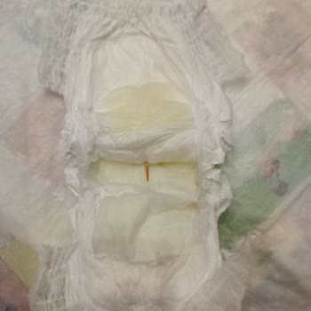 Bebek Bezinde Odun Parçası Bulunması Ve Güven Sorunu