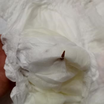 Bebek Bezinde Odun Parçası Bulunması Ve Güven Sorunu