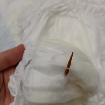 Bebek Bezinde Odun Parçası Bulunması Ve Güven Sorunu