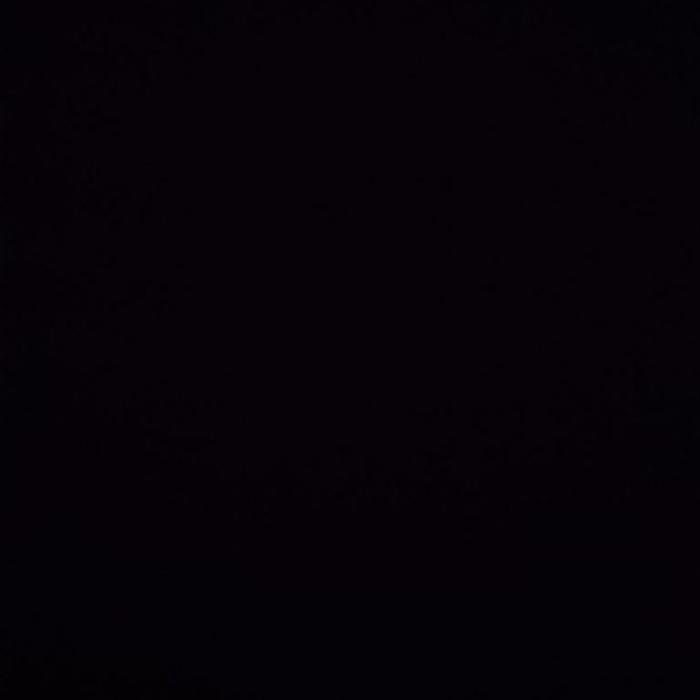 Aksis Premium Güzellik Salonunda Randevu Gecikmesi Ve Etkisiz Lazer Epilasyon