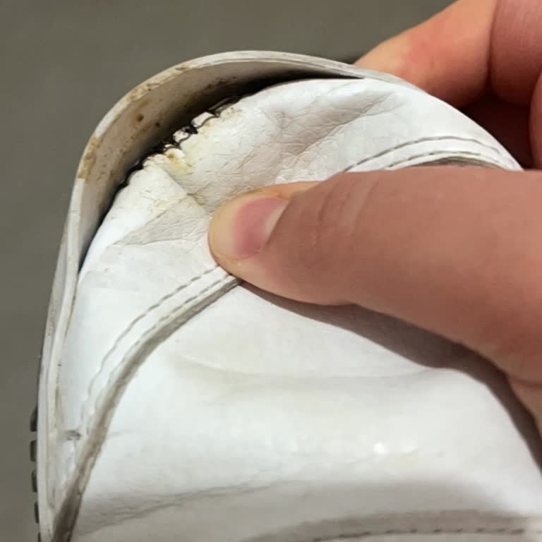 Adidas Ayakkabısının Ön Kısmının Hızlı Kırılması Ve İade Talebi